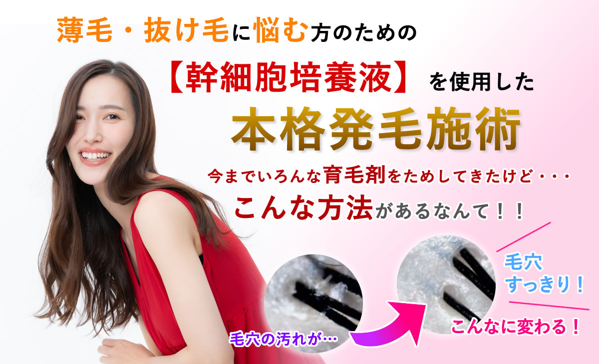 薄毛・抜け毛に悩む方の為の【幹細胞培養液】を使用した本格発毛施術